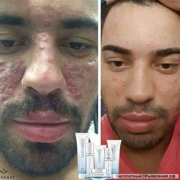 Омолаживающий комплекс
