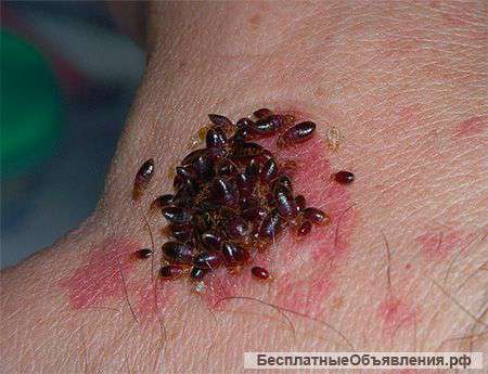 Уничтожение клопов, тараканов