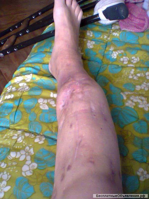 Помогите Нуждаюсь в материальной помощи