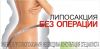 Ультразвуковая липосакция (кавитация)