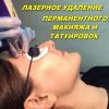 Лазерное удаление некачественного татуажа и татуировок