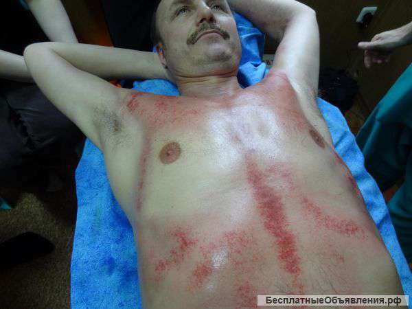 Гуаша - китайская техника оздоравливающего массажа