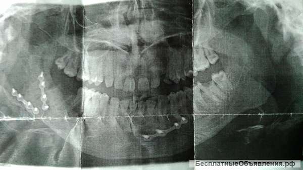 Нуждаюсь в деньгах