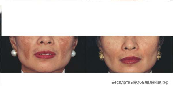 Услуги косметолога- эстетиста