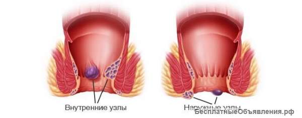 Народная медицина
