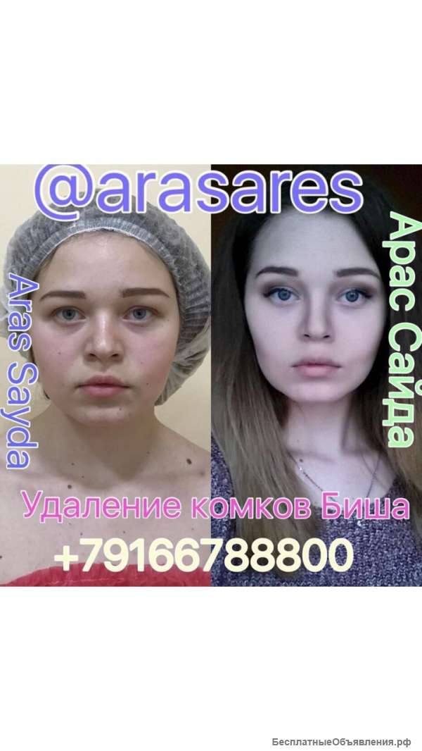 Требуются модели для демонстрации современных методов омоложения