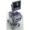 УЗИ/УЗД аппарат SIEMENS X300