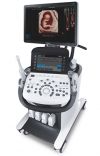 Аппарат Узи Samsung Medison ugeo h60-rus 2015г