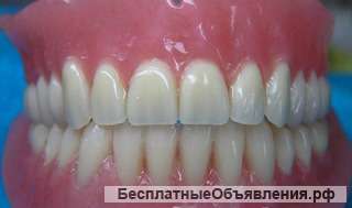 Зубные протезы