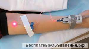 Лазерное и ультрафиолетовое облучение крови