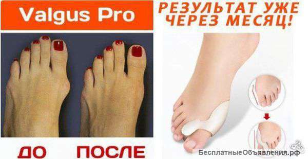 Фиксатор большого пальца Valgus Pro