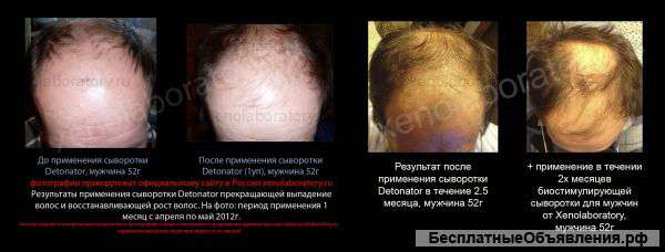 Сыворотка для возобновления роста волос Xenolaboratory-Detonator