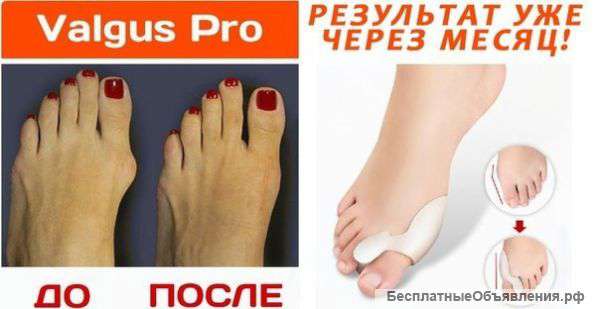 Valgus Pro - средство от выпирающей "косточки"