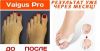 Valgus Pro - средство от выпирающей "косточки"