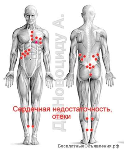 Гирудотерапия. Лечение пиявками.