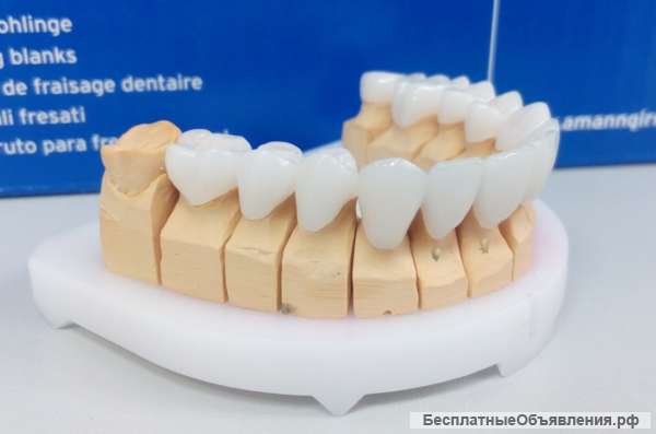 Виниры и вкладки Cerec вместо пломб