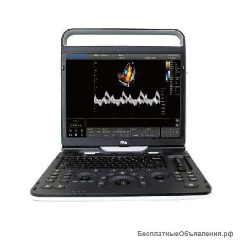 Аппарат УЗИ Chison Ebit 60