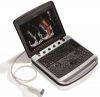 Аппарат УЗИ Chison SonoBook 9