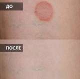 Катушки Мишина (2 шт.) + генератор