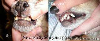 Ультрозвуковая чистка зубов без наркоза