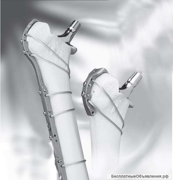 Набор для остеосинтеза трубчатых костей