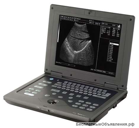 AcuVista RS880c портативный УЗИ сканер