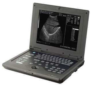 AcuVista RS880c портативный УЗИ сканер