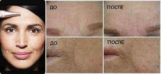 Крем-филлер для глубоких морщин TimeWise Repair®