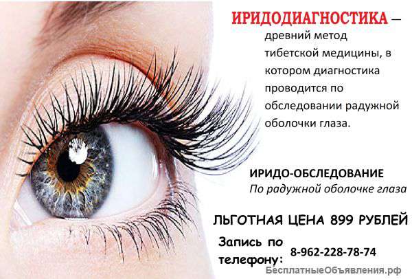 Иридодиагностика