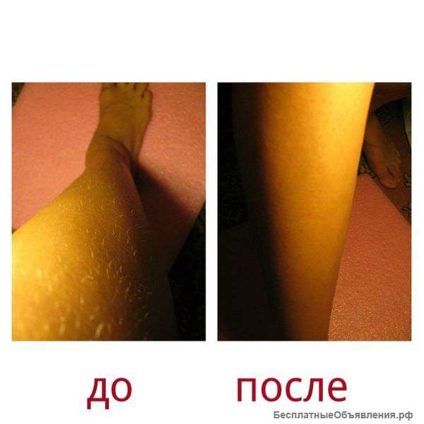 Шугаринг на дому Москва, ЮЗАО