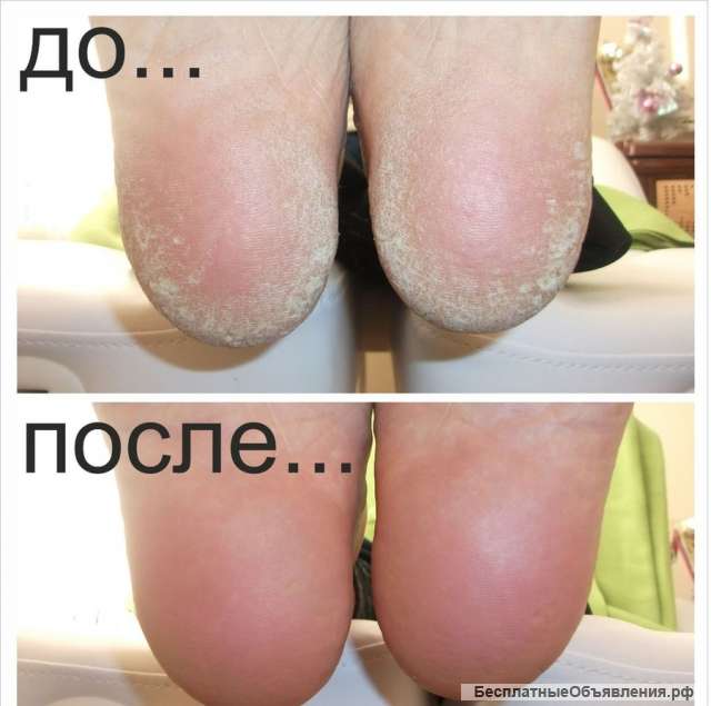 Преглашаю на педикюр
