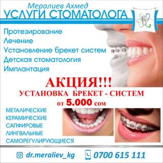 Акция Установка Брекет-Систем от 5000 сом