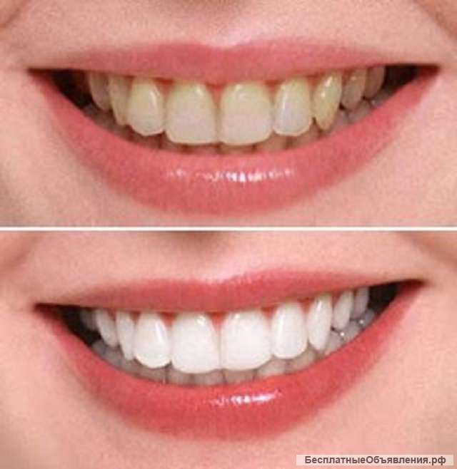 Услуги стоматолога