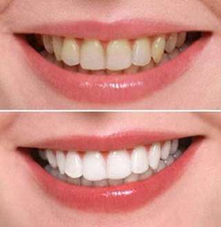 Услуги стоматолога