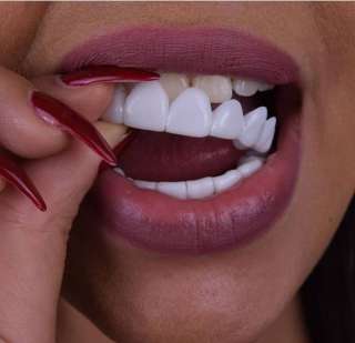 Инновационные виниры для зубов Perfect Smile Veneers