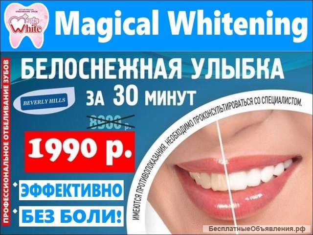 Стоматолог, Отбеливание зубов в Сочи