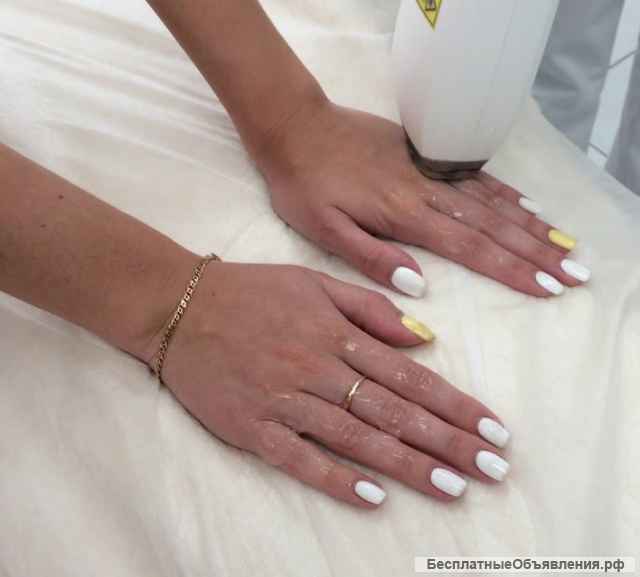 Лазерная эпиляция In-Motion D1 с Гарантированным результатом