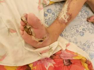 Помогите на лечения