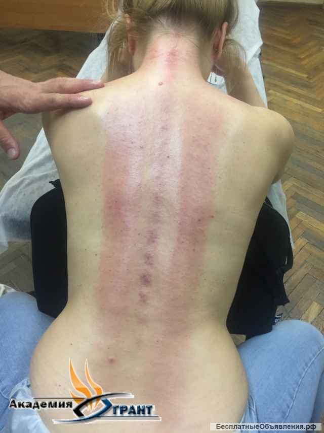 Курс массаж Гуаша