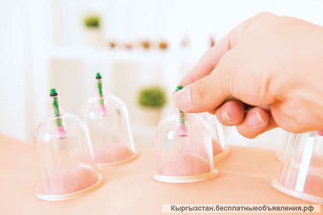 Хиджама по Сунне