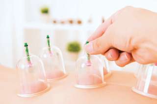 Хиджама по Сунне