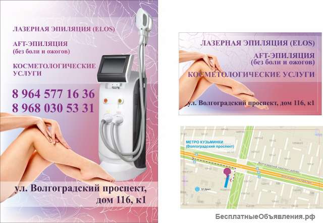 Лазерная эпиляция