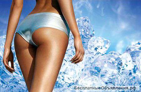 Криолиполиз