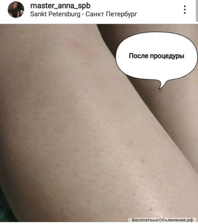 Услуги шугаринга