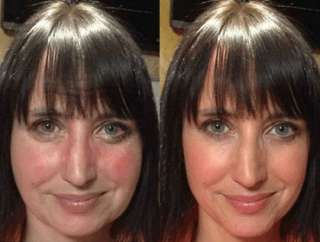 «LIFTENSYN - сыворотка против морщин