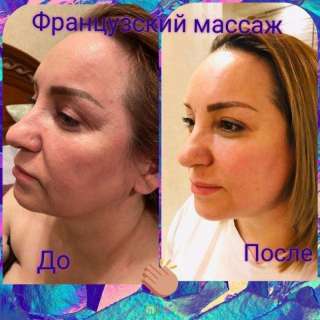 Массаж лица