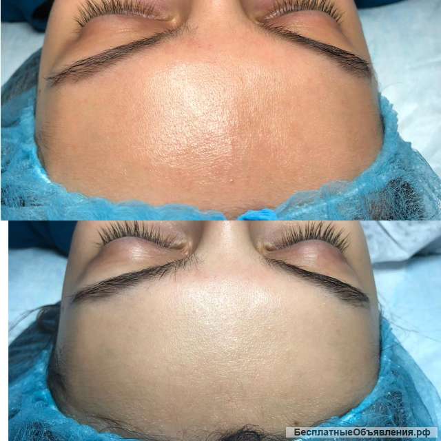 Косметолог, чистка лица