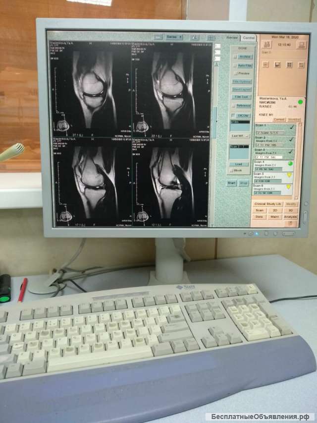 МРТ HITACHI Airis Elite 0.3T