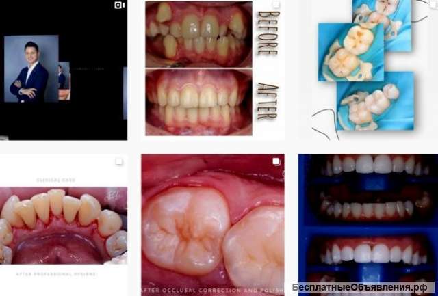 Профессиональное оказание медицинских услуг в стоматологической клинике «DENTIS»