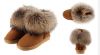 UGG Women Fox Fur) Угги с мехом лисы